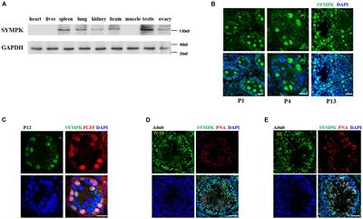 SYMPK Is Required for Meiosis and Involved in Alternative Splicing in Male Germ Cells